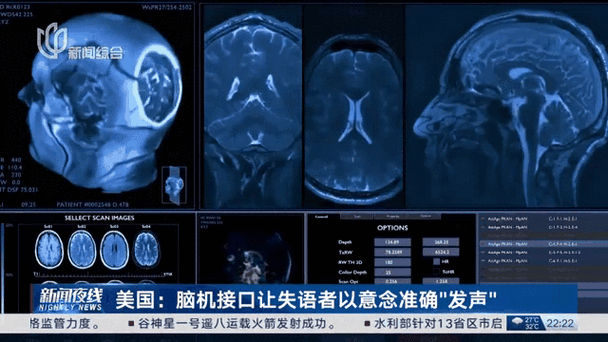 脑机接口的伦理困境：读取思想的技术，人类真的准备好了吗？
